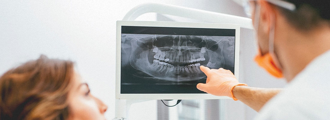 انواع رادیوگرافی دندان
