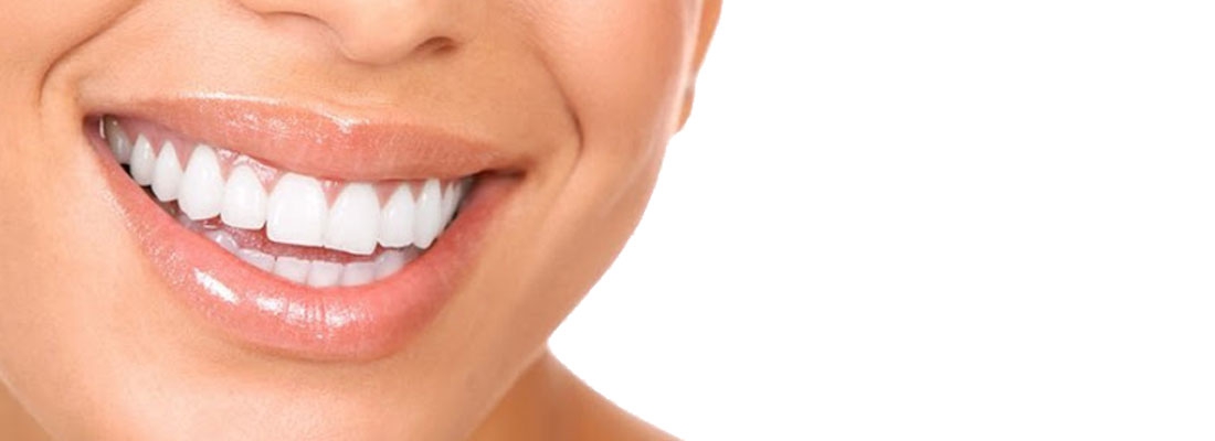 هزینه جراحی افزایش طول تاج دندان