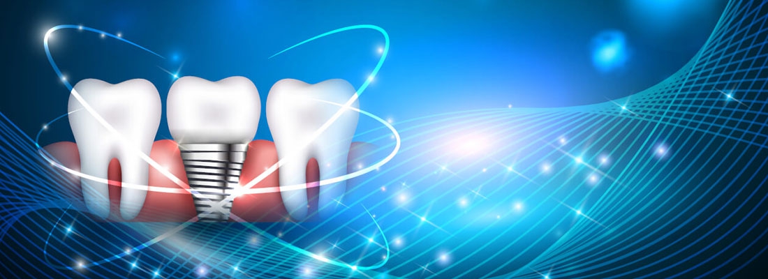 جدیدترین تکنولوژی کاشت دندان