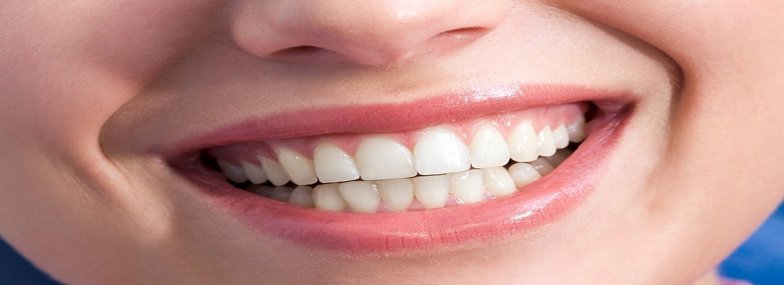 سفید شدن لثه و کشیدن دندان