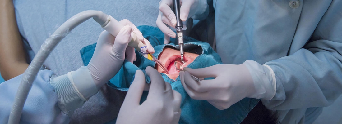 کاهش ورم صورت بعد از جراحی دندان