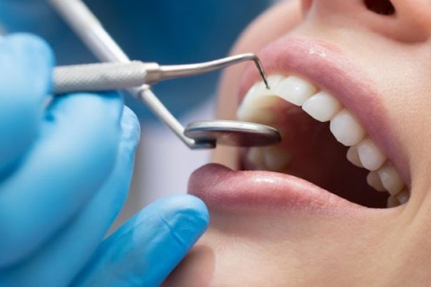 ترمیم یک سطحی دندان چیست