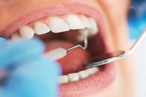 ترمیم سه سطحی دندان چیست