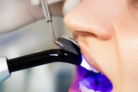 عوارض سفید کردن دندان