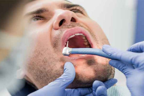 جراح دندان عقل خوب در تهران