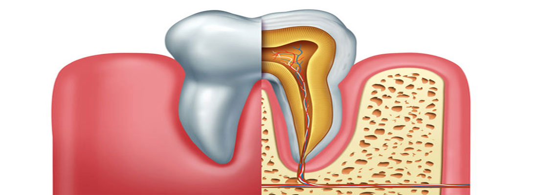 متخصص درد ریشه دندان