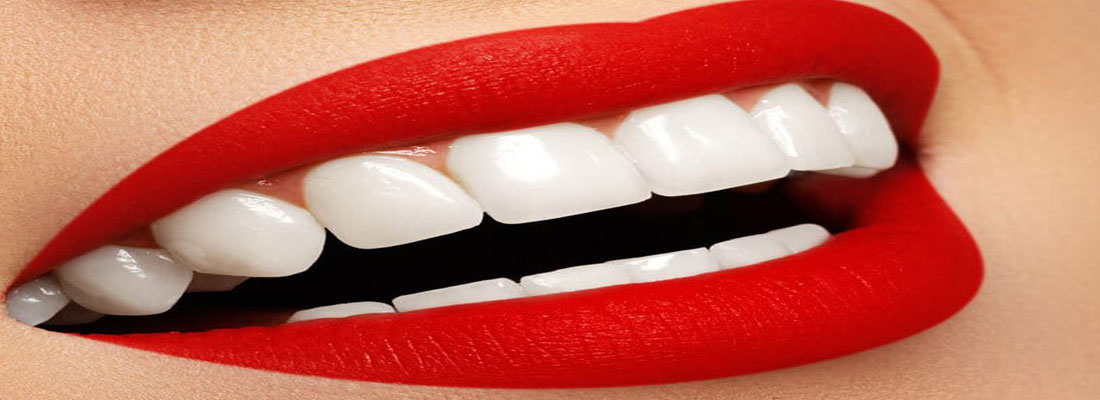 انواع اقدامات در دندانپزشکی زیبایی