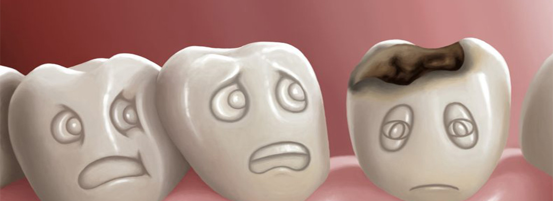 از کجا بفهمیم دندان ما