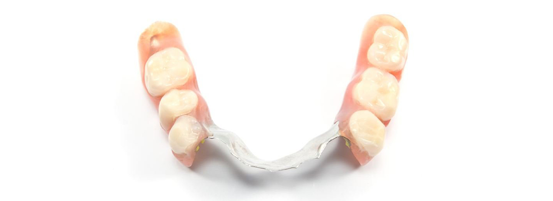 دندان مصنوعی پارسیل یا تکه ای