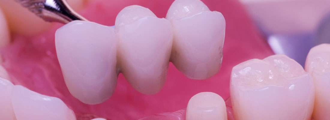 آشنایی با ساختار دندان سالم