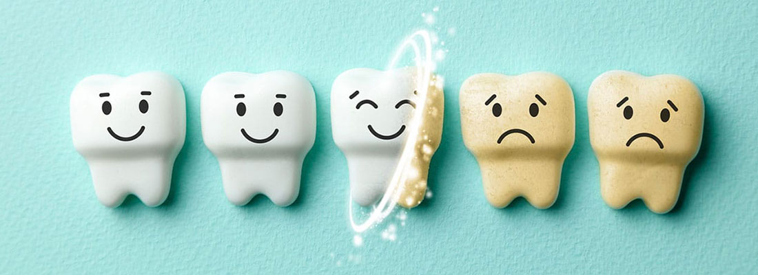 روش های جلوگیری از تغییر رنگ دندان