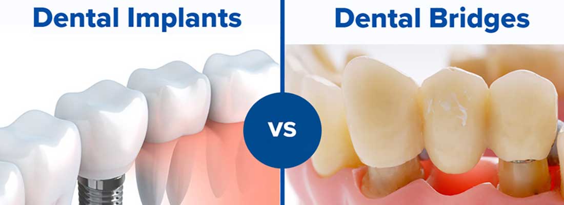 تفاوت رنگ با بقیه دندان ها