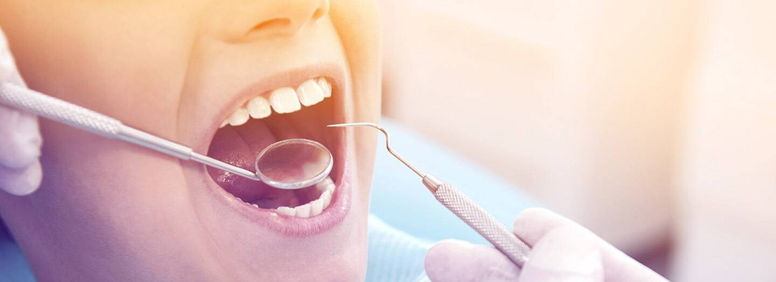 درباره میناکاری دندان بیشتر بدانید