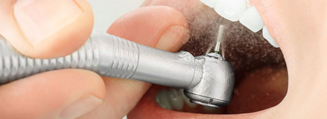 راهکار های پزشکی برای درمان کرم خوردگی دندان