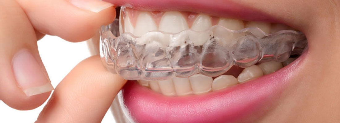 راه های درمان دندان قروچه