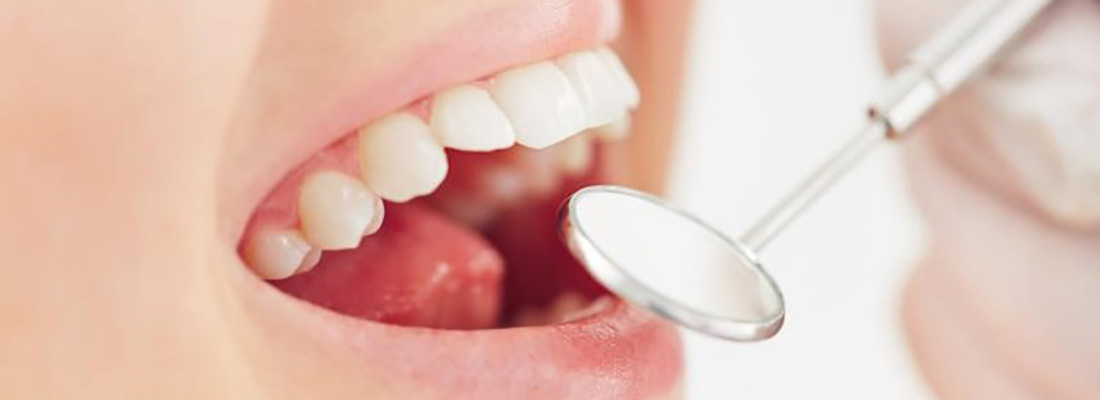 راه های مراقبت ازمینای دندان