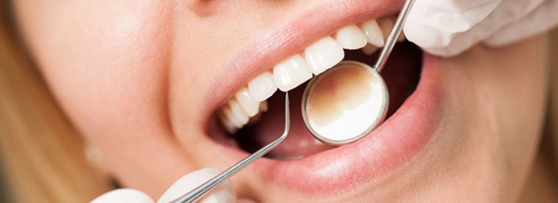 روش های متداول ترمیم دندان
